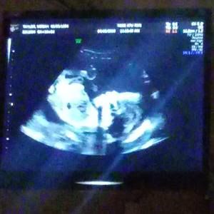 Meet your Posher, Odessa